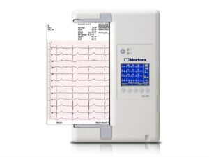 ECG