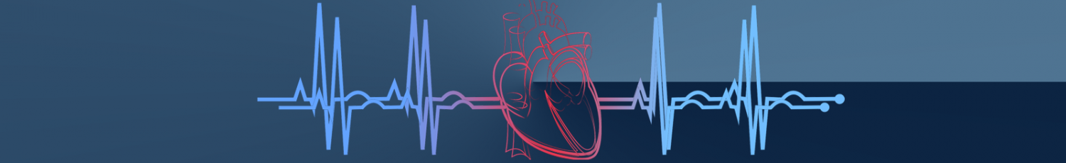 EKG-line